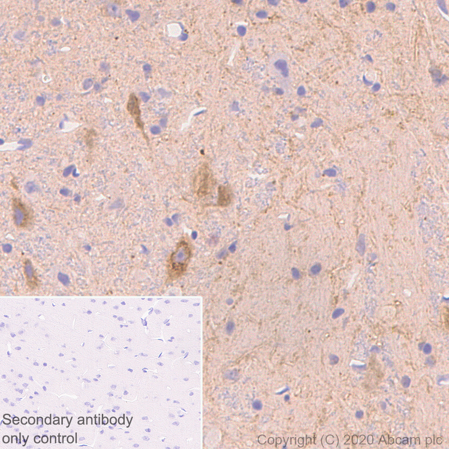 Immunohistochemistry (Formalin/PFA-fixed paraffin-embedded sections) - Anti-NPTX2 antibody [EPR24020-38] - BSA and Azide free (ab277533), expandable thumbnail