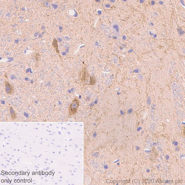 Immunohistochemistry (Formalin/PFA-fixed paraffin-embedded sections) - Anti-NPTX2 antibody [EPR24020-38] - BSA and Azide free (AB277533)