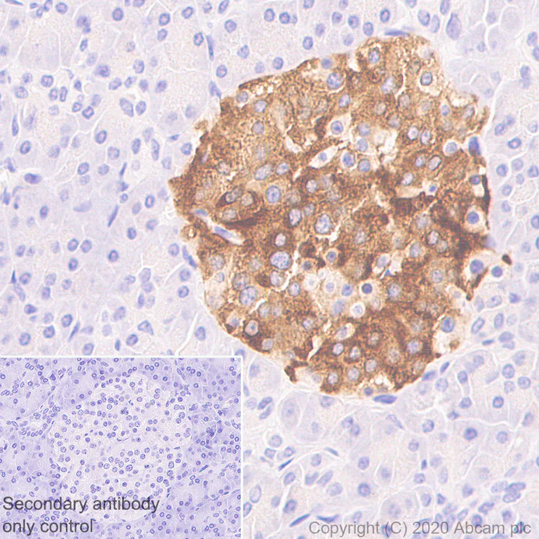 Immunohistochemistry (Formalin/PFA-fixed paraffin-embedded sections) - Anti-NPTX2 antibody [EPR24020-38] - BSA and Azide free (AB277533)