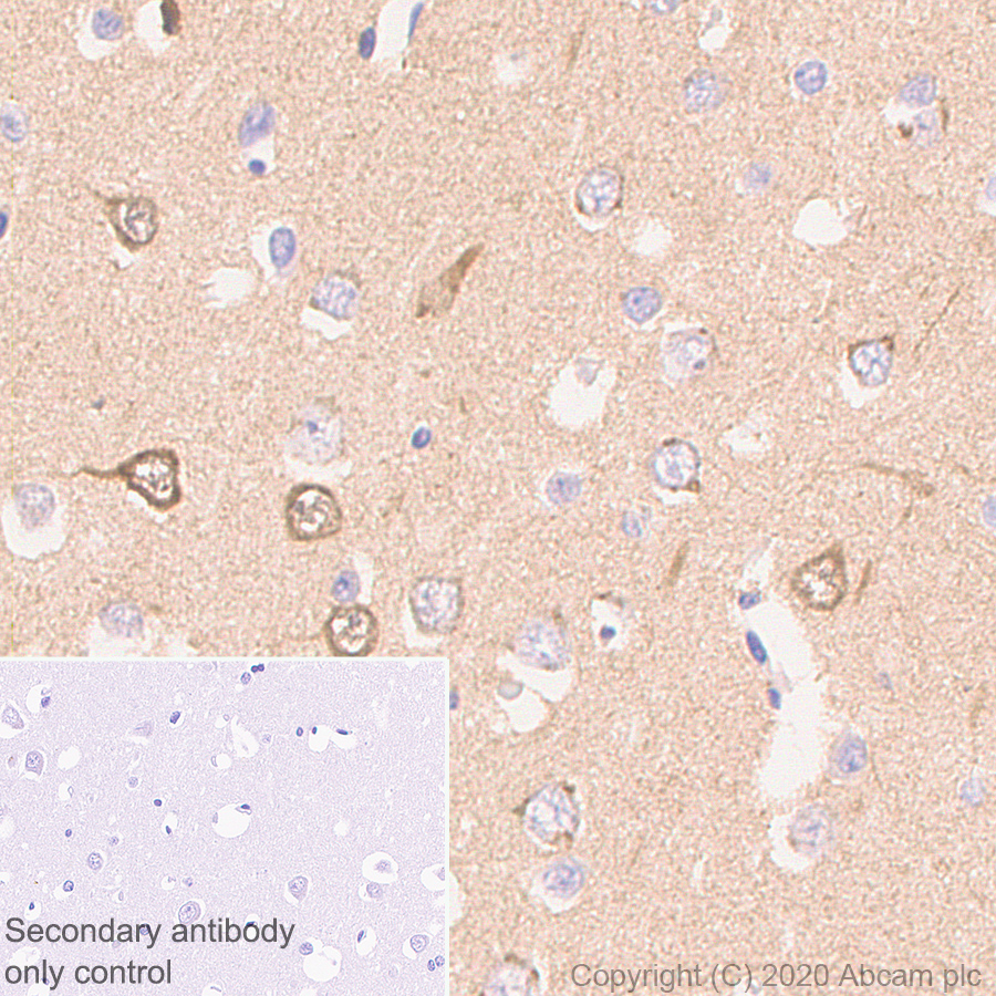 Immunohistochemistry (Formalin/PFA-fixed paraffin-embedded sections) - Anti-NPTX2 antibody [EPR24020-38] - BSA and Azide free (AB277533), expandable thumbnail