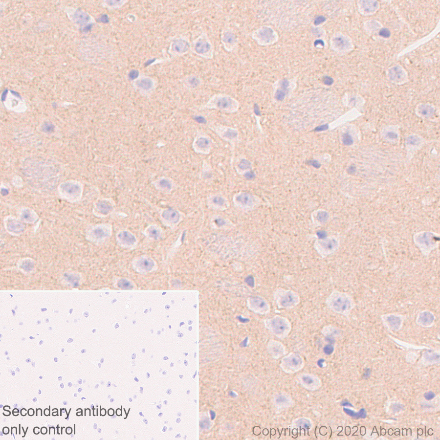 Immunohistochemistry (Formalin/PFA-fixed paraffin-embedded sections) - Anti-NPTX2 antibody [EPR24020-38] - BSA and Azide free (AB277533), expandable thumbnail