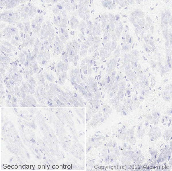 Immunohistochemistry (Frozen sections) - Anti-NPTX2 antibody [EPR24020-38] - BSA and Azide free (ab277533), expandable thumbnail