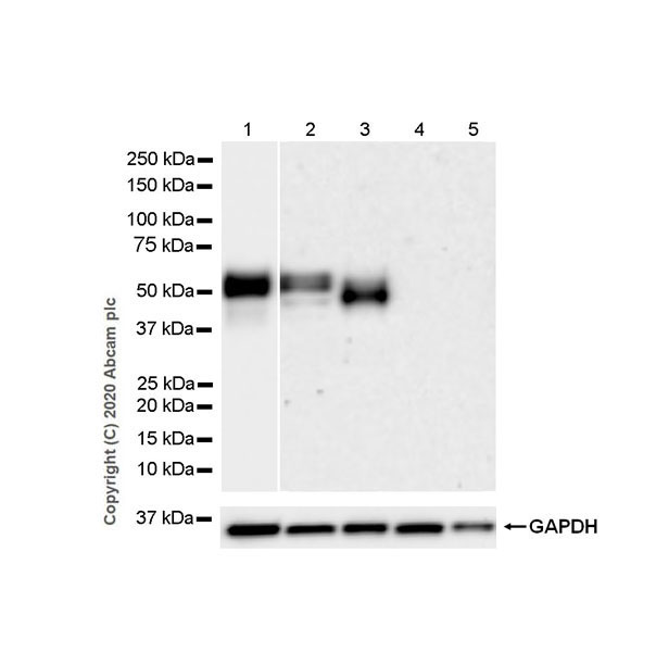 Western blot - Anti-NPTX2 antibody [EPR24020-38] - BSA and Azide free (ab277533), expandable thumbnail