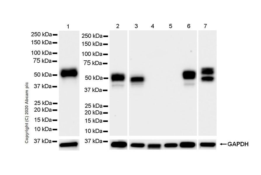 Western blot - Anti-NPTX2 antibody [EPR24020-38] - BSA and Azide free (AB277533), expandable thumbnail