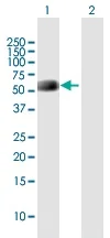 Western blot - Anti-NPTXR antibody (AB168254)