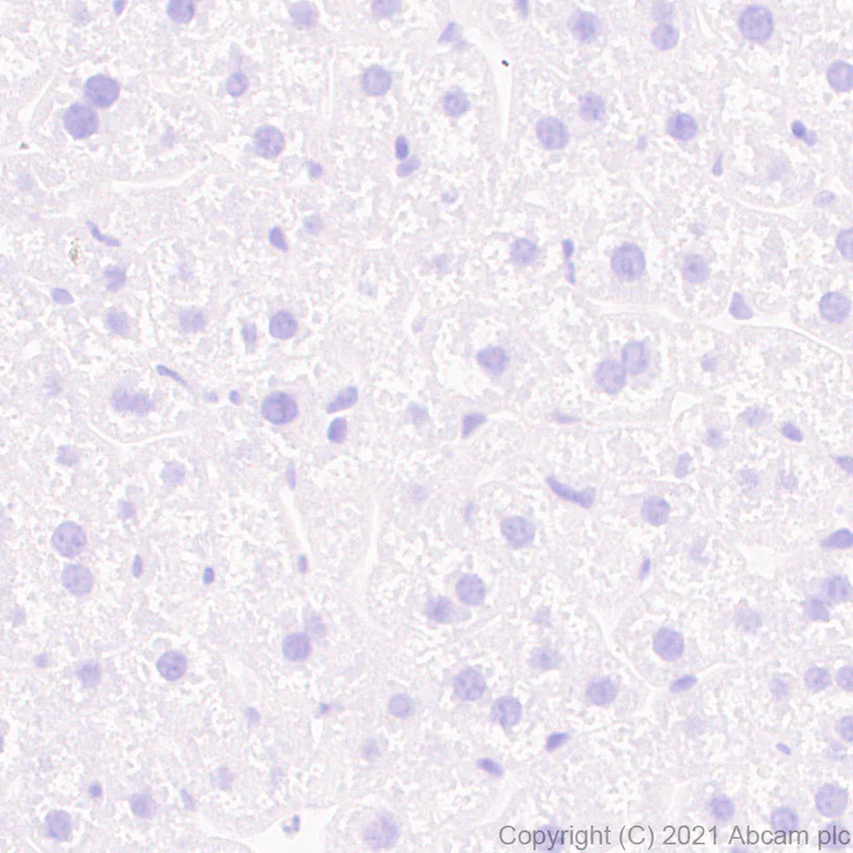 Immunohistochemistry (Formalin/PFA-fixed paraffin-embedded sections) - Anti-NPTXR antibody [EPR25684-3] (AB289860)