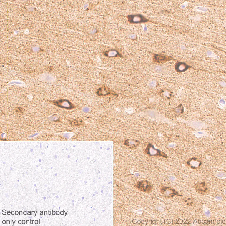 Immunohistochemistry (Formalin/PFA-fixed paraffin-embedded sections) - Anti-NPTXR + NPTX2 + NPTX1 antibody [EPR25684-9] - BSA and Azide free (AB289870)