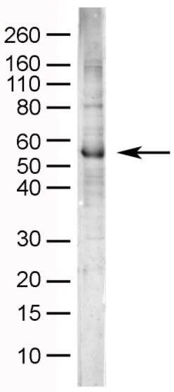 Western blot - Anti-NPY1R antibody (AB35336)