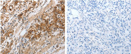 Immunohistochemistry (Formalin/PFA-fixed paraffin-embedded sections) - Anti-NPY1R antibody - C-terminal (AB183108)