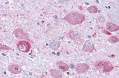Immunohistochemistry (Formalin/PFA-fixed paraffin-embedded sections) - Anti-NPY1R antibody - Cytoplasmic domain (AB219266)