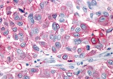 Immunohistochemistry (Formalin/PFA-fixed paraffin-embedded sections) - Anti-NPY1R antibody - Cytoplasmic domain (AB219266)