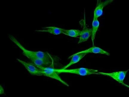 Immunocytochemistry/ Immunofluorescence - Anti-NPY5R antibody [EPR8382] (AB133757)