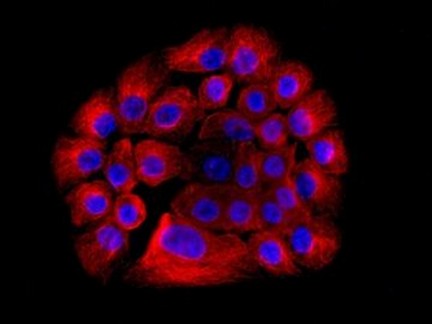 Immunocytochemistry/ Immunofluorescence - Anti-NPY5R antibody [EPR8382] (AB133757)