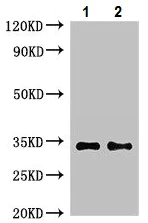 Western blot - Anti-NPY6R antibody (AB223515)