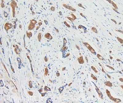 Immunohistochemistry (Formalin/PFA-fixed paraffin-embedded sections) - Anti-NQO1 antibody [A180] (ab28947), expandable thumbnail