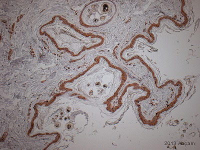 Immunohistochemistry (Formalin/PFA-fixed paraffin-embedded sections) - Anti-NQO1 antibody [A180] (AB28947), expandable thumbnail
