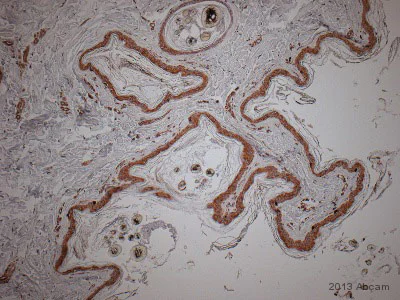 Immunohistochemistry (Formalin/PFA-fixed paraffin-embedded sections) - Anti-NQO1 antibody [A180] (AB28947)