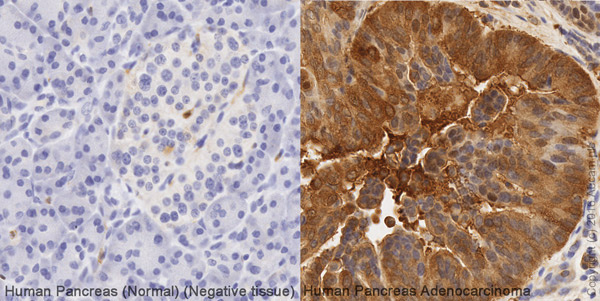 Immunohistochemistry (Formalin/PFA-fixed paraffin-embedded sections) - Anti-NQO1 antibody [A180] (ab28947), expandable thumbnail