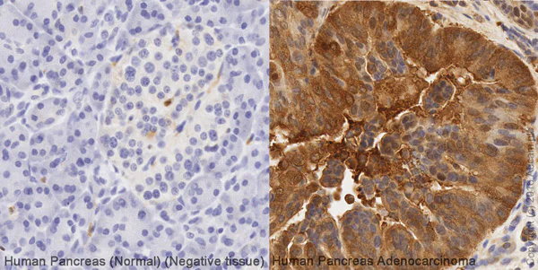 Immunohistochemistry (Formalin/PFA-fixed paraffin-embedded sections) - Anti-NQO1 antibody [A180] - BSA and Azide free (AB264434)