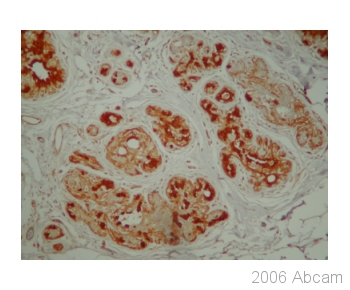 Immunohistochemistry (Formalin/PFA-fixed paraffin-embedded sections) - Anti-NQO1 antibody [A180] - BSA and Azide free (AB264434)