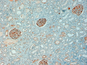 Immunohistochemistry (Formalin/PFA-fixed paraffin-embedded sections) - Anti-NQO1 antibody (AB2346)