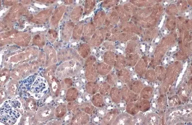 Immunohistochemistry (Formalin/PFA-fixed paraffin-embedded sections) - Anti-NQO1 antibody (AB97385)