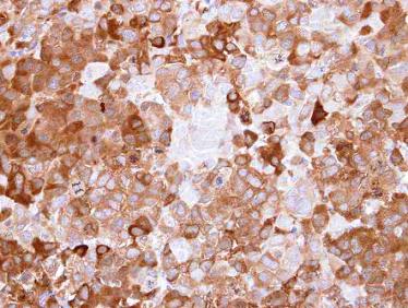 Immunohistochemistry (Formalin/PFA-fixed paraffin-embedded sections) - Anti-NQO1 antibody (AB97385), expandable thumbnail
