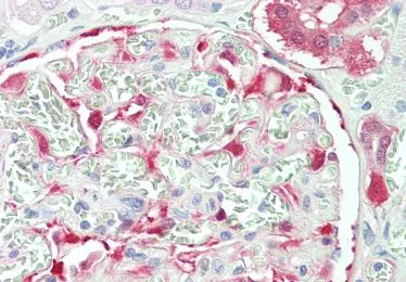 Immunohistochemistry (Formalin/PFA-fixed paraffin-embedded sections) - Anti-NQO1 antibody - C-terminal (AB219769)