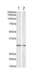 Western blot - Anti-NQO1 antibody - C-terminal (AB219769)