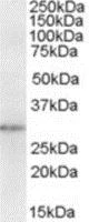Western blot - Anti-NQO1 antibody - C-terminal (AB219769)
