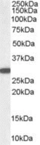 Western blot - Anti-NQO1 antibody - C-terminal (AB219769)