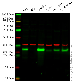 Western blot - Anti-NQO1 antibody [EPR3309] (AB80588), expandable thumbnail