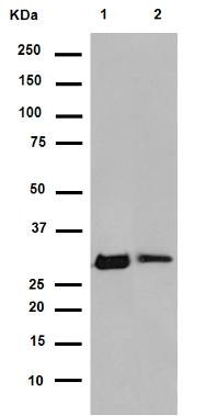 Western blot - Anti-NQO1 antibody [EPR3309] (AB80588), expandable thumbnail