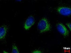 Immunocytochemistry/ Immunofluorescence - Anti-NQO2 antibody (AB137612)