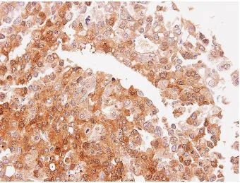 Immunohistochemistry (Formalin/PFA-fixed paraffin-embedded sections) - Anti-NQO2 antibody (AB137612)