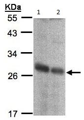 Western blot - Anti-NQO2 antibody (AB137612)