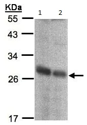 Western blot - Anti-NQO2 antibody (AB137612)