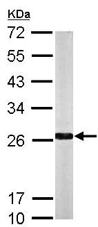 Western blot - Anti-NQO2 antibody (AB137612)