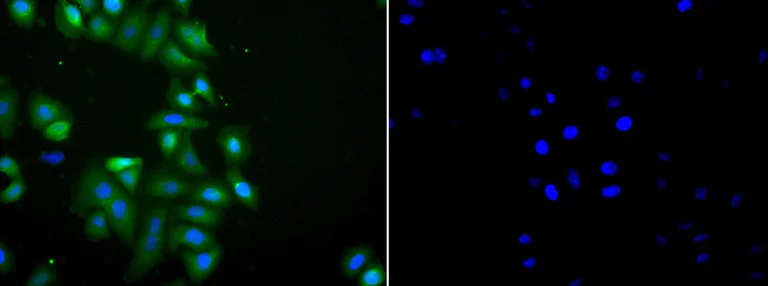 Immunocytochemistry/ Immunofluorescence - Anti-NQO2 antibody (AB236917)