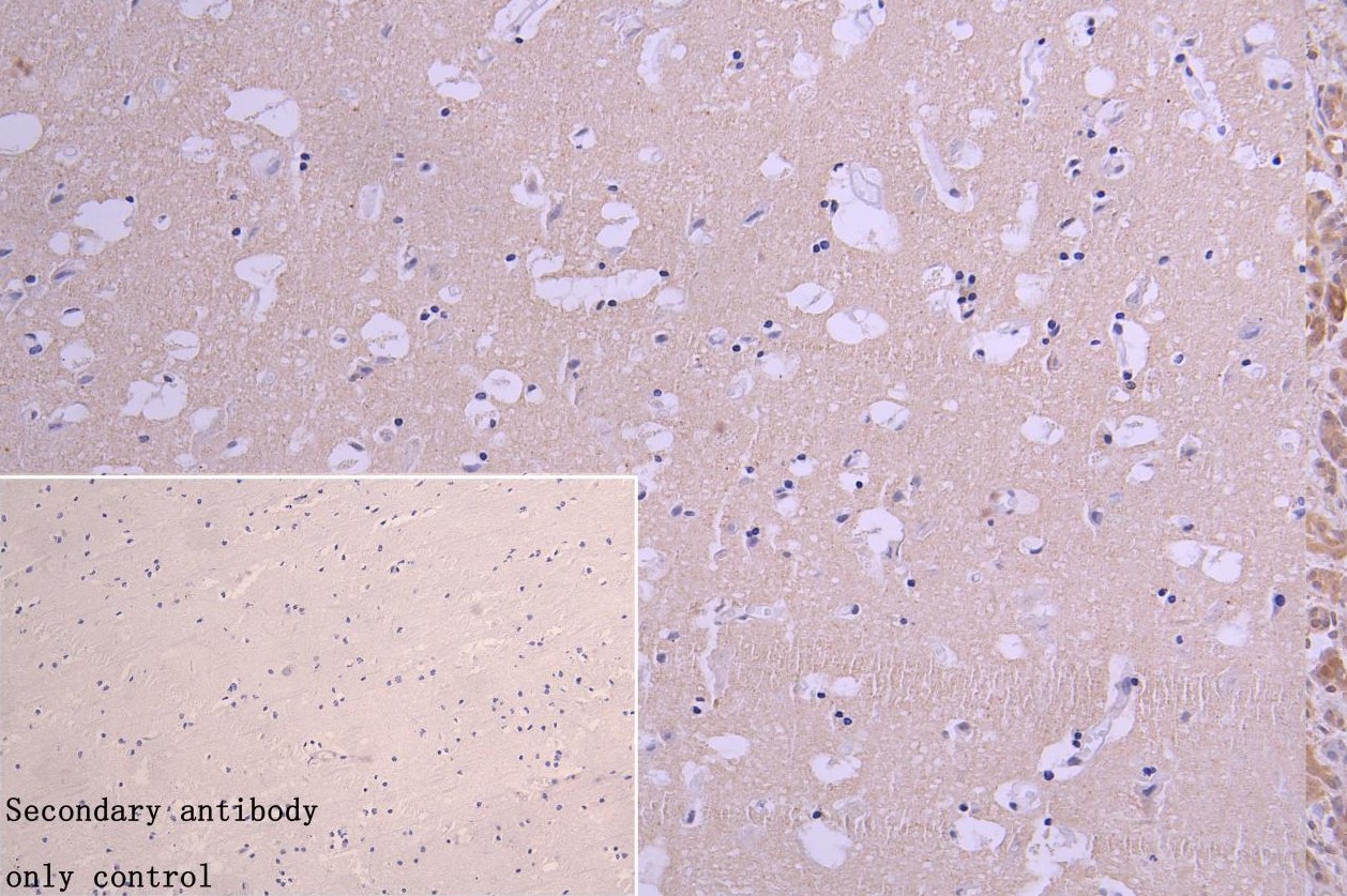 Immunohistochemistry (Formalin/PFA-fixed paraffin-embedded sections) - Anti-NQO2 antibody (AB236917), expandable thumbnail