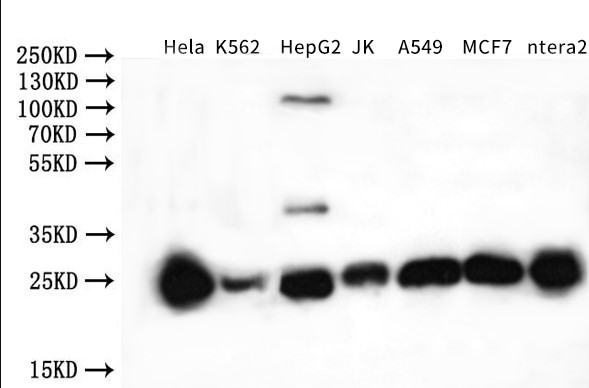 Western blot - Anti-NQO2 antibody (AB236917), expandable thumbnail