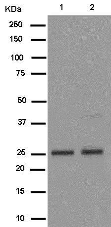 Western blot - Anti-NQO2 antibody [EPR13345] (AB181049), expandable thumbnail