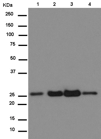 Western blot - Anti-NQO2 antibody [EPR13345] - BSA and Azide free (AB250309)