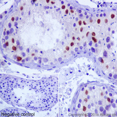 Immunohistochemistry (Formalin/PFA-fixed paraffin-embedded sections) - Anti-NR0B1 / Dax1 antibody [EP13786] - N-terminal (AB196649), expandable thumbnail