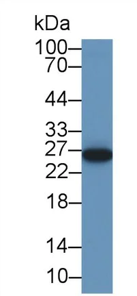Western blot - Anti-NR0B2 antibody (AB232841)