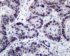 Immunohistochemistry (Formalin/PFA-fixed paraffin-embedded sections) - Anti-NR1D1 + NR1D2 / RVR antibody [EPR10376] - BSA and Azide free (AB236008)