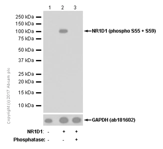 Western blot - Anti-NR1D1 (phospho S55 + S59) antibody [EPR18346-44] - BSA and Azide free (AB251057)