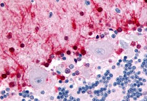 Immunohistochemistry (Formalin/PFA-fixed paraffin-embedded sections) - Anti-NR1D2 / RVR antibody (AB188747)