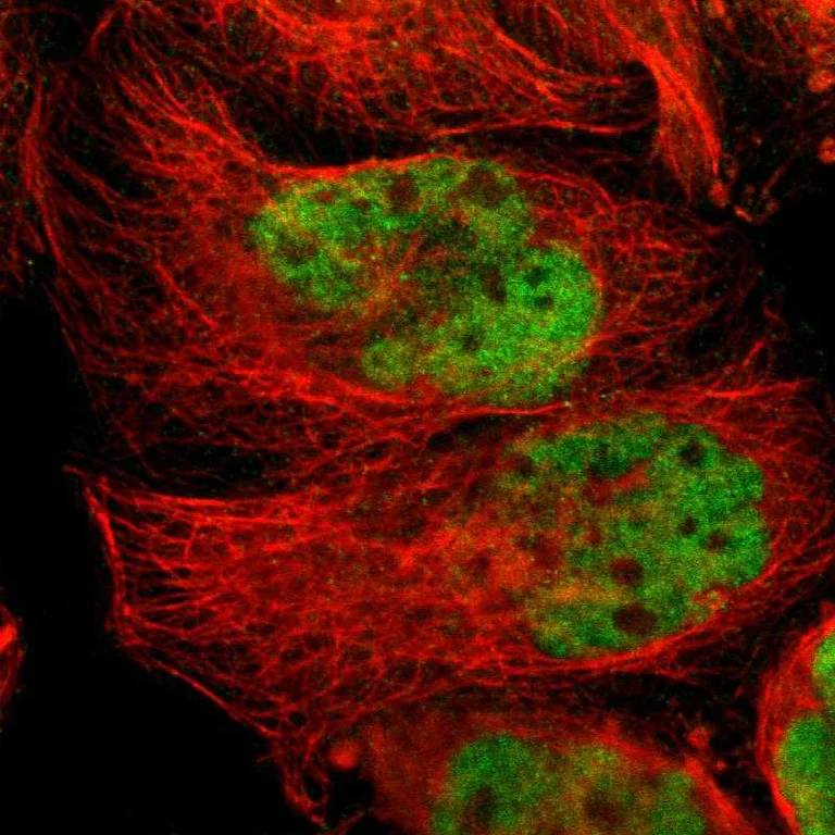 Immunocytochemistry/ Immunofluorescence - Anti-NR2C2 Antibody (AB327185)