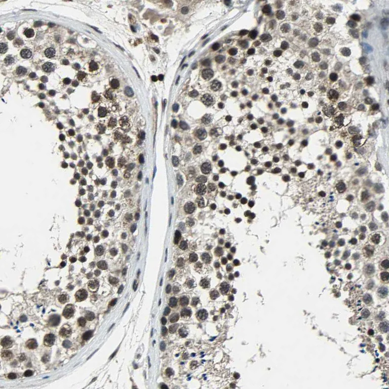 Immunohistochemistry (Formalin/PFA-fixed paraffin-embedded sections) - Anti-NR2C2 Antibody (AB327185)